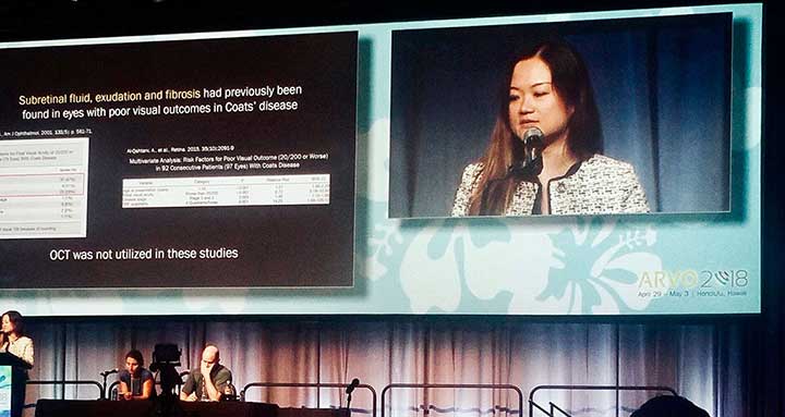 Photo of Sally Ong presenting her work at ARVO
